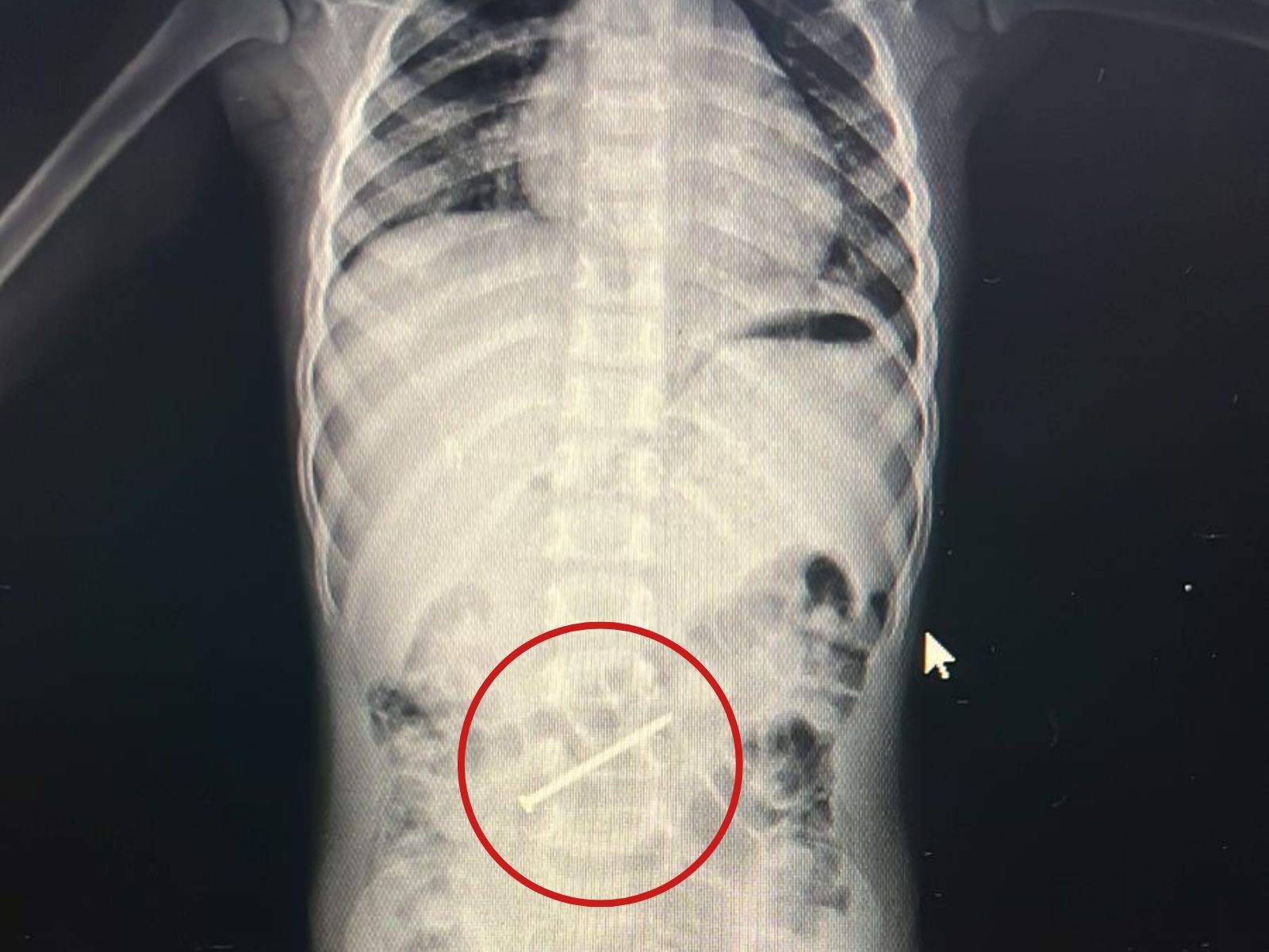 foto Not&iacute;cia Tarauacá